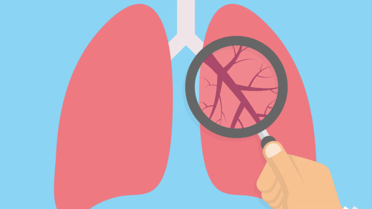 Scientists Can Detect 17 Diseases Using Only a Patient’s Breath
