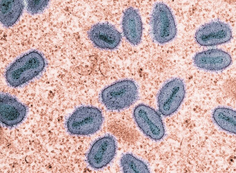 Severe Variant of Mpox Detected in the U.S. for the First Time in San Mateo County
