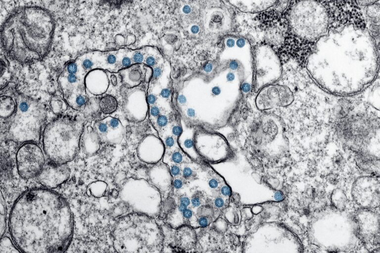 Candida Auris: The Deadly Fungus Spreading Across the US