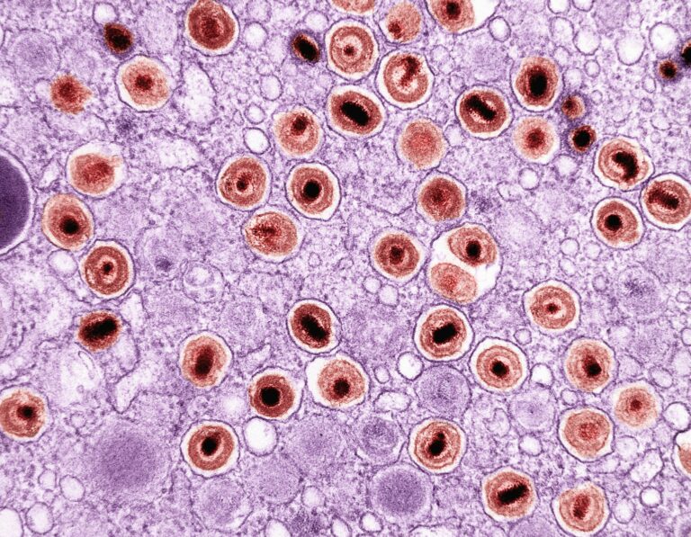 Meningococcemia: Teen Death Sparks Urgent Vaccine Reminder
