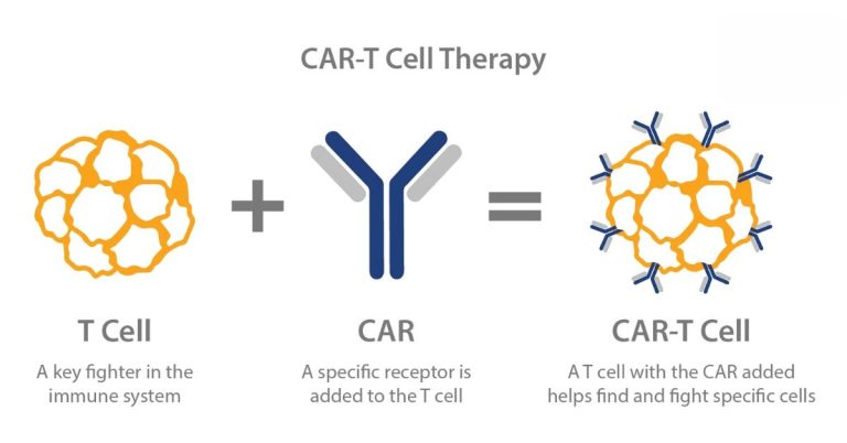 CAR-T Therapy Multiple Sclerosis Trials Show Hope for Patients