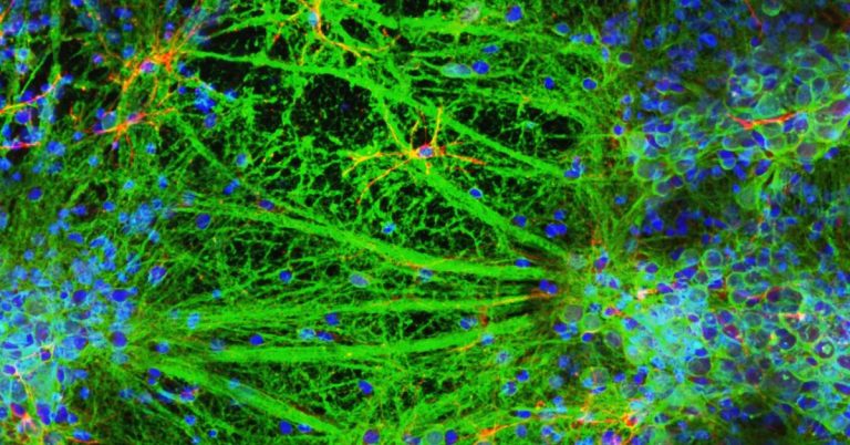 Living brain cells: Revolutionize Machine Learning